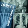 lo-ray-radiologia-domiciliare